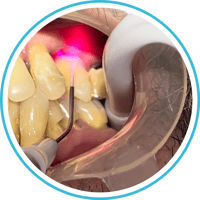 Periodoncia ML