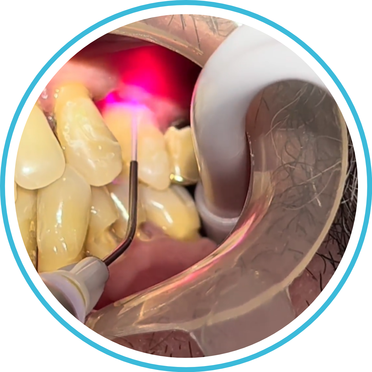 Periodoncia ML